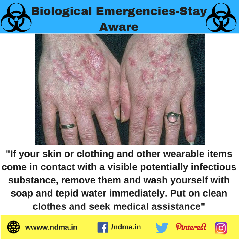 If your skin or clothing comes in contact with a visible potentially infectious substance, remove and wash them immediately.